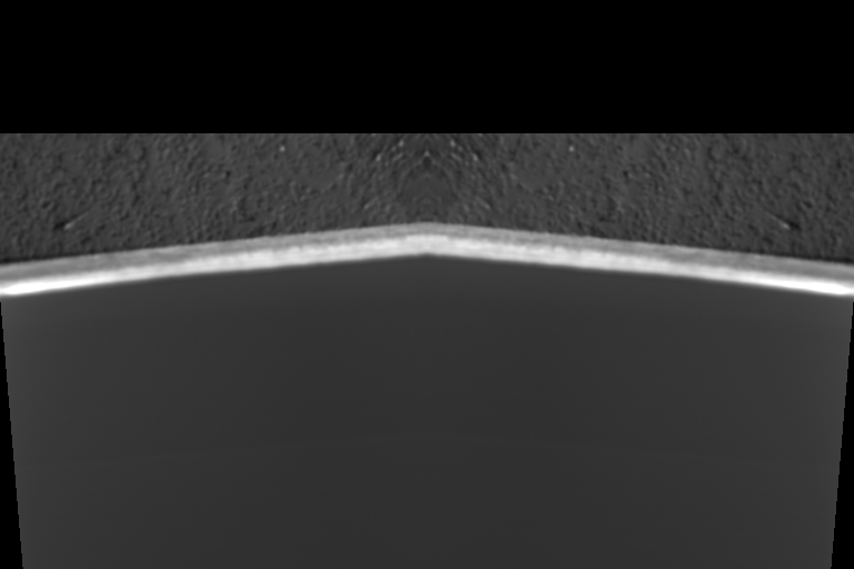 fib_image